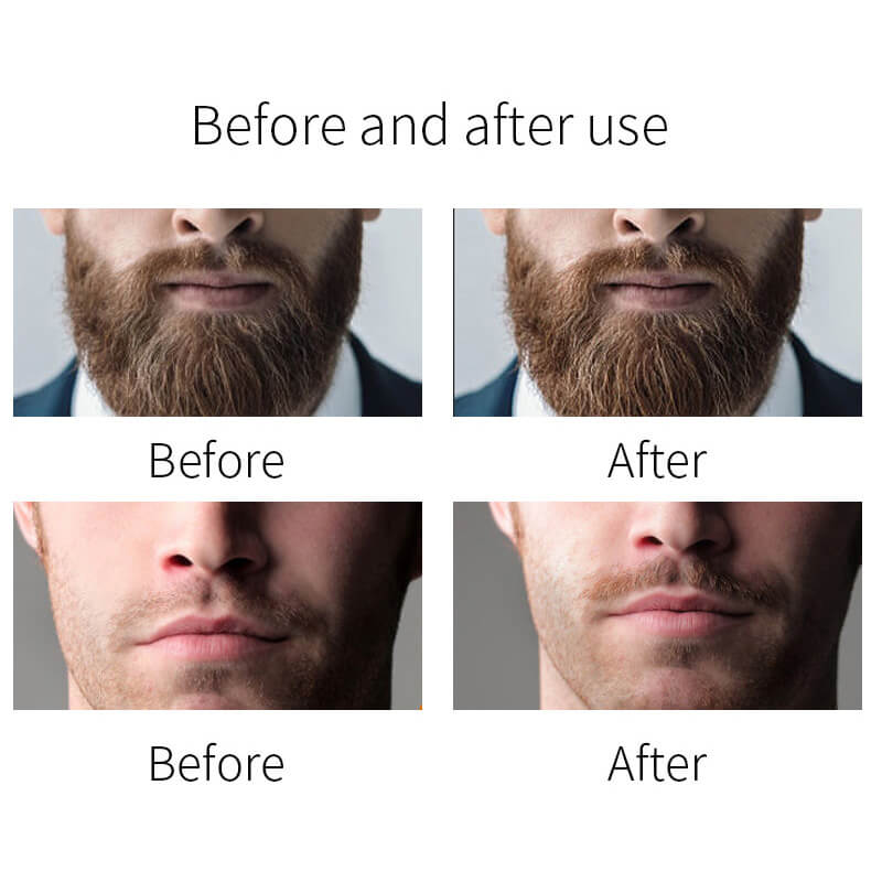 Nourishing Beard Oil